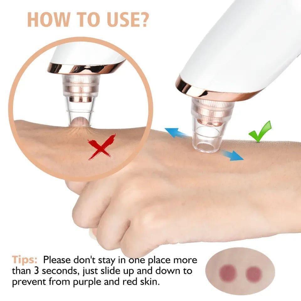 Blackhead & Dead Skin Remover High-Quality Synthetic Material