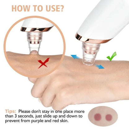 Blackhead & Dead Skin Remover High-Quality Synthetic Material