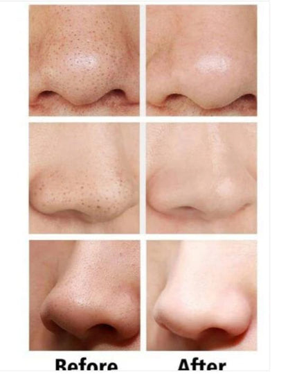 Blackhead & Dead Skin Remover High-Quality Synthetic Material